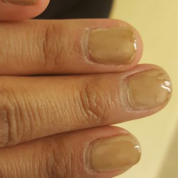 Nail Pros And Spa - My gel nails a week after.  Had them done on 12/3/2016 and these were my nails on 12/10/2016.  Very embarrassing and a poor quality! - Nail Salons Near Me - Camarillo, California