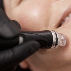 Succulent Skin by Kim