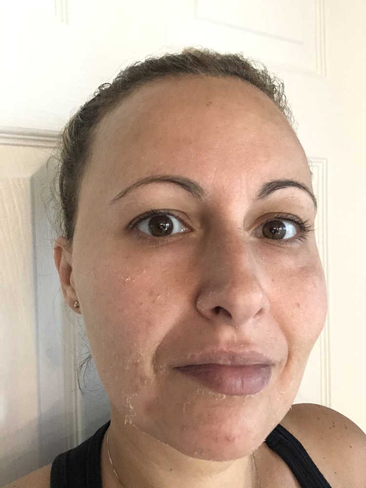 LASER BY NICOLE 660 9th St N, Naples, Florida Laser Hair Removal