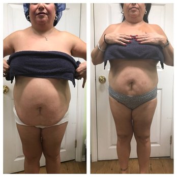 Splendor spa - Masajes reductores,cavitacion,manta de radiacion infraroja,carboxiterapia - Skin Care Near Me - Brooklyn, New York Splendor spa - Masajes reductores,cavitacion,manta de radiacion infraroja,carboxiterapia - Skin Care Near Me - Brooklyn, New York