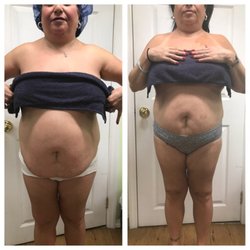 Splendor spa - Masajes reductores,cavitacion,manta de radiacion infraroja,carboxiterapia