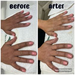 Omni Beauty Spa - Results after one Hand Treatment