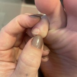 US Nail Salon - Look how much of my toenail was cut off. WHY?