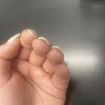 Zen Nail Spa - Finger tips with weird substance - Nail Salons Near Me - Chattanooga, Tennessee Zen Nail Spa - Finger tips with weird substance - Nail Salons Near Me - Chattanooga, Tennessee