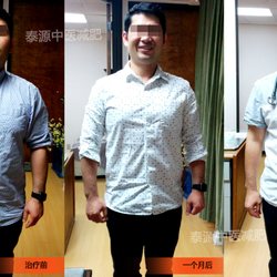 DAO Acupuncture Clinic - Acupuncture for weight lose Real Patient