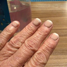 Nails after 5 days. I would have been better off going to Walmart nail salon.  I paid 128.00 dollars for this. Never again will I go there.