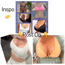 Advanced Institute for Plastic Surgery - My inspiration photos vs where I'm at now
