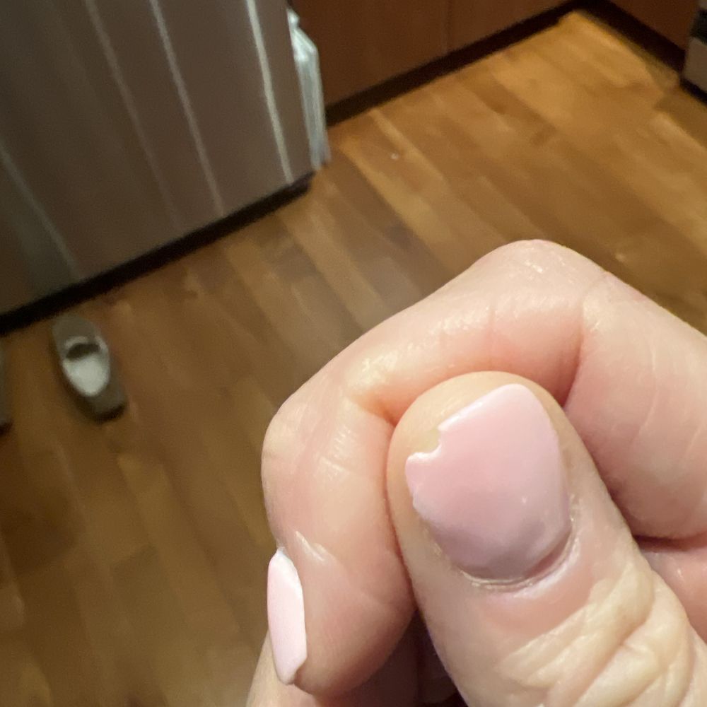 Athena Nail Boutique - My second chipped thumb. Laughable!!!! - Nail Salons Near Me - Albuquerque, New Mexico