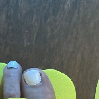 District Nails - Bleeding toenail - Nail Salons Near Me - Washington, DC, District of Columbia District Nails - Bleeding toenail - Nail Salons Near Me - Washington, DC, District of Columbia