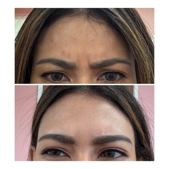 Aesthetiks - Botox - Medical Spas Near Me - Riverside, California Aesthetiks - Botox - Medical Spas Near Me - Riverside, California