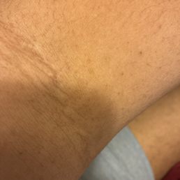 You can barely see where GABBY took my blood You can barely see where GABBY took my blood
