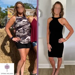 Optimal Wellness Cape Coral - Medical Weight Loss Before and After at Optimal Wellness Cape Coral