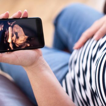 Sneak a Pic - Live share ultrasound with loved ones! - Day Spas Near Me - Sugar Land, Texas Sneak a Pic - Live share ultrasound with loved ones! - Day Spas Near Me - Sugar Land, Texas