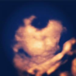 One Peaceful Birth