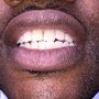Photo of The Whitening Bar