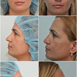 Carlos Spera, MD