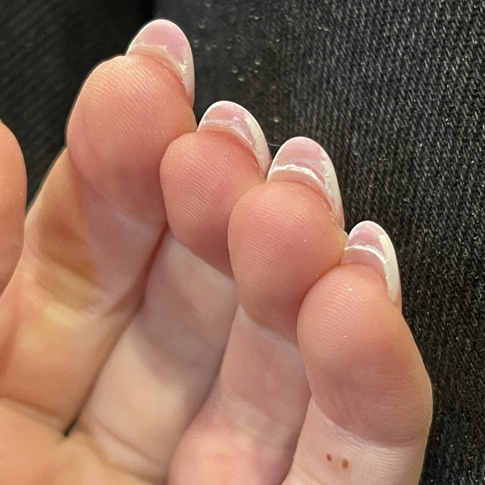 Nail Art Studio - My actual nail not even connected to the dip? - Nail Salons Near Me - Northbrook, Illinois Nail Art Studio - My actual nail not even connected to the dip? - Nail Salons Near Me - Northbrook, Illinois