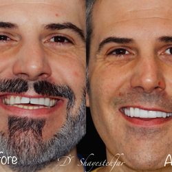 Mojdeh Shayestehfar, DDS - Linden Dental Care - Full mouth rehabilitation