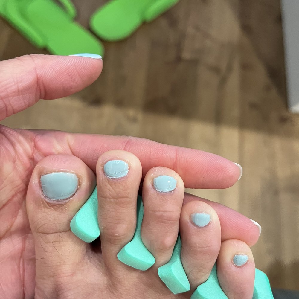 Pronails and Spa in Gainesville - Botched pedicure - Hair Removal Near Me - Gainesville, Florida Pronails and Spa in Gainesville - Botched pedicure - Hair Removal Near Me - Gainesville, Florida