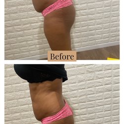 House of curves - Non invasive body treatments