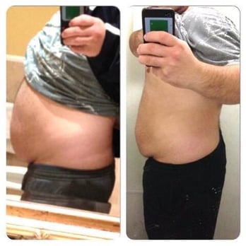 Better Built Body - 1 Month of Zerona results - Body Contouring Near Me - Toronto, Ontario Better Built Body - 1 Month of Zerona results - Body Contouring Near Me - Toronto, Ontario