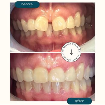 M&C Dental Services - Invisalign can help you achieve the smile you deserve. - Oral Surgeons Near Me - Miami, Florida M&C Dental Services - Invisalign can help you achieve the smile you deserve. - Oral Surgeons Near Me - Miami, Florida
