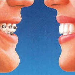 Wood Orthodontics - McAuliff & Wood Ortho