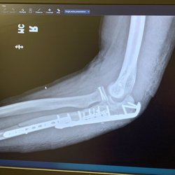 ARC Physical Therapy + - Same as the first picture