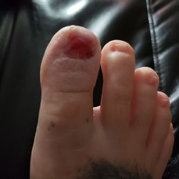 DESTROYED MY TOE NAIL. PLACE IS DIRTY!