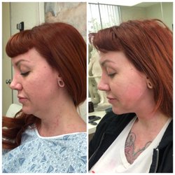 Before and after
