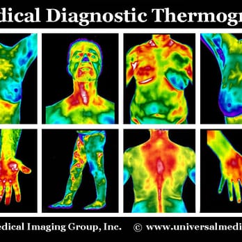 Universal Medical Imaging Group - Diagnostic Medical Thermography - Diagnostic Imaging Near Me - Valley Village, California Universal Medical Imaging Group - Diagnostic Medical Thermography - Diagnostic Imaging Near Me - Valley Village, California