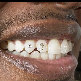 Personal Dental - 2 teeth Gems - Dental Hygienists Near Me Personal Dental - 2 teeth Gems - Dental Hygienists Near Me