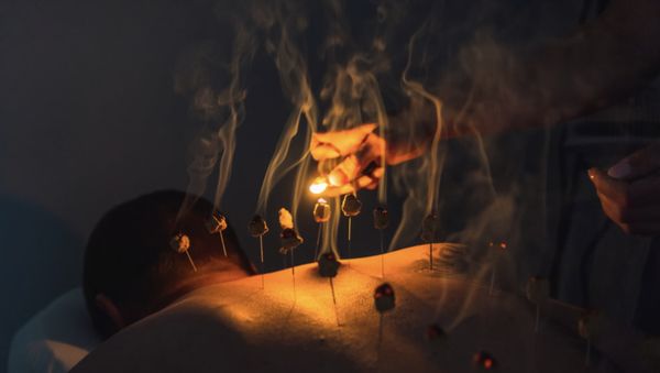 Moxibustion - Acupuncture is well known to alleviate pain. Hair-thin needles are used in specific locations on the body depending on the diagnosis of your tongue, pulse, and medical diagnosis. The acupuncturist will observe the shape, color, wetness, coat of your tongue, and the feel of your pulse. These determine other factors that may be contributing to your pain. If indicated, other modalities may be used such as cupping, moxibustion, guasha, and patent herbs. Moxibustion - Acupuncture is well known to alleviate pain. Hair-thin needles are used in specific locations on the body depending on the diagnosis of your tongue, pulse, and medical diagnosis. The acupuncturist will observe the shape, color, wetness, coat of your tongue, and the feel of your pulse. These determine other factors that may be contributing to your pain. If indicated, other modalities may be used such as cupping, moxibustion, guasha, and patent herbs.