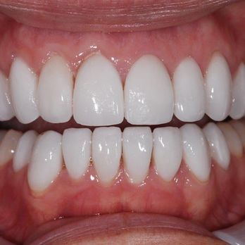 Jeffrey S Cummings, DMD - A sample of our life changing work. - General Dentistry Near Me - Waltham, Massachusetts