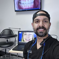 The Dental Method - Dentist of Dallas - Dr. Reddy completing a Veneer and Smile Design makeover in Dallas
