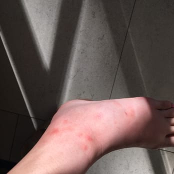 Nail Time - RINGWORM!!! - Nail Salons Near Me - Burbank, California Nail Time - RINGWORM!!! - Nail Salons Near Me - Burbank, California