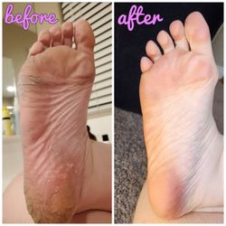 Vegas Nail Bar - Years of pedicures elsewhere & home treatment didn't fix my feet, Tina did in 5 pedicures. January 2024
