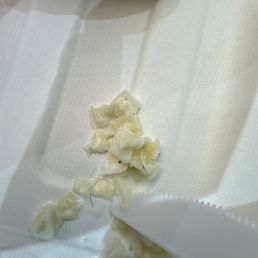 Hair in my food