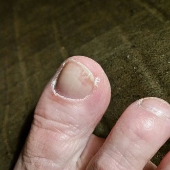 Lee Nails& Spa - Then seen this strange area which again resembles nail fungus. Not happy at all!!! - Nail Salons Near Me - Hampton, Virginia Lee Nails& Spa - Then seen this strange area which again resembles nail fungus. Not happy at all!!! - Nail Salons Near Me - Hampton, Virginia