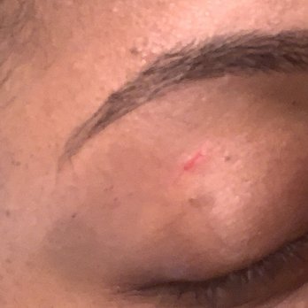 Unique Eyebrow Threading - Scratches still bleeding after getting services on Saturday. It is now Monday. - Eyebrow Services Near Me - Round Rock, Texas