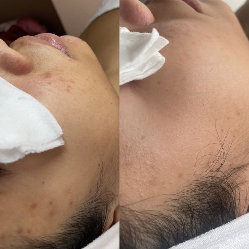 glutathione skin lightening chicago TOP 10 BEST in Chicago, IL - (2026 Guide) Beyond Canonical GPCR Desensitization: