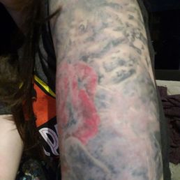 This is the scarring and how awful it looks now.