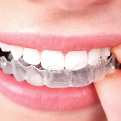 Ideal Orthodontics - Untitled