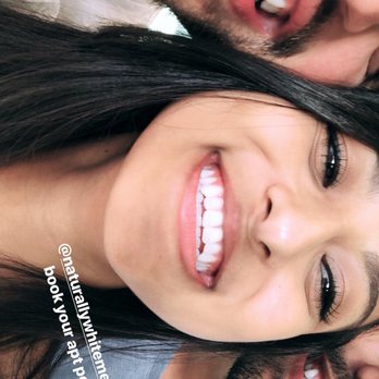 Naturally White Memorial - Final results - Teeth Whitening Near Me - Houston, Texas Naturally White Memorial - Final results - Teeth Whitening Near Me - Houston, Texas