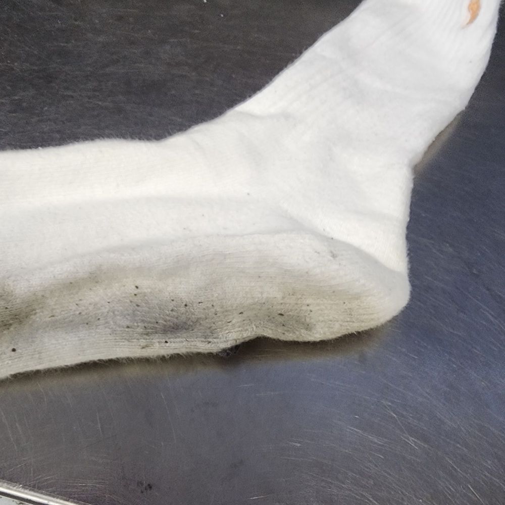 Most of the whites seemed unwashed. Most of the whites seemed unwashed.