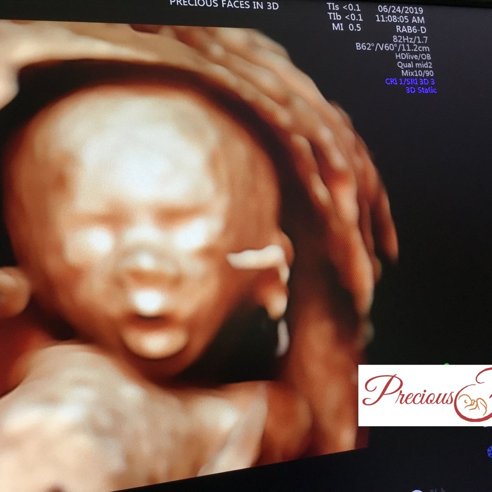 3d Ultrasound Union Nj edu.svet.gob.gt