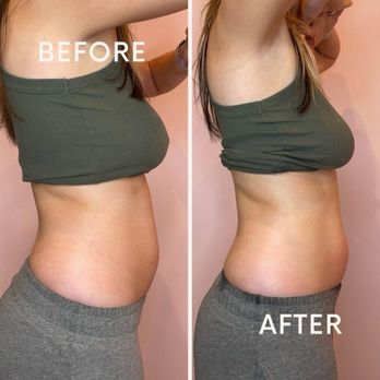 Seattle Barbies - Body Contouring Near Me - Renton, Washington