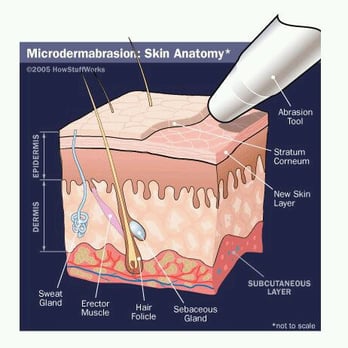 Evolve Skincare - Microdermabrasion offered at Evolve Skin & Yoga. - Skin Care Near Me - Citrus Heights, California Evolve Skincare - Microdermabrasion offered at Evolve Skin & Yoga. - Skin Care Near Me - Citrus Heights, California
