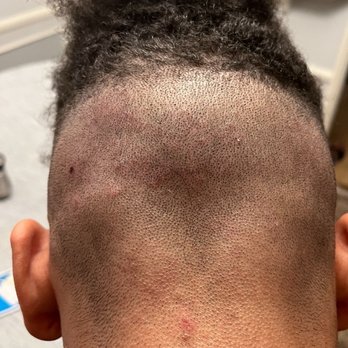 Rudy's Barber Shop - Red infected areas from this place - Barbers Near Me - Culver City, California Rudy's Barber Shop - Red infected areas from this place - Barbers Near Me - Culver City, California