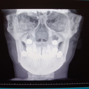 Leiker Orthodontics - Conroe - I-CAT 3-D Image - Orthodontists Near Me - Conroe, Texas Leiker Orthodontics - Conroe - I-CAT 3-D Image - Orthodontists Near Me - Conroe, Texas